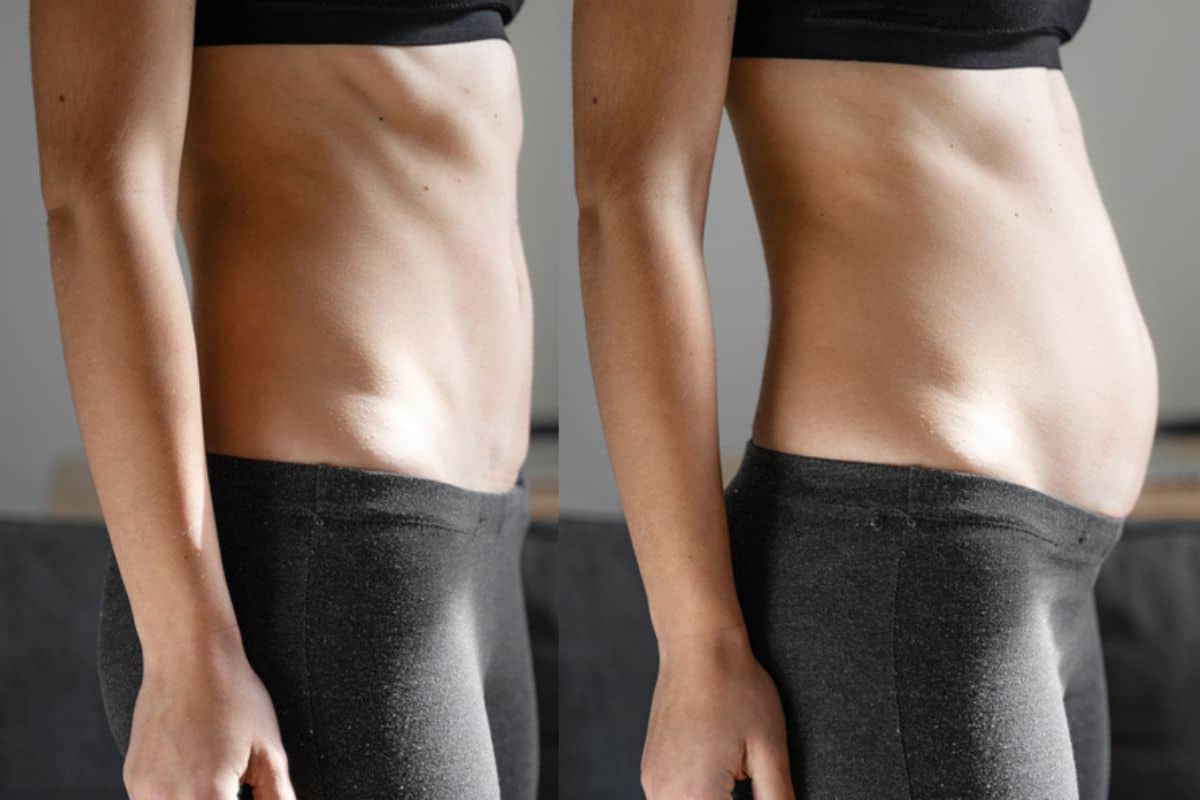 How long does diastasis recti take to improve Worcester Park?
