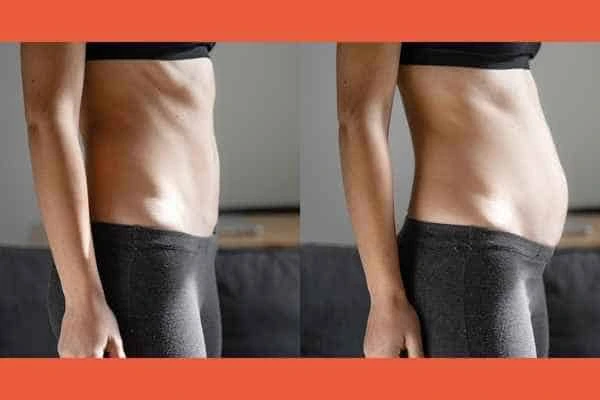 LA-EMS Body Sculpting results Worcester Park
