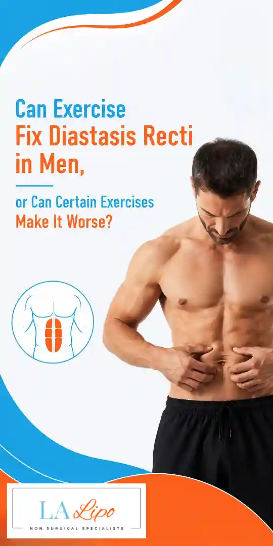 Can Exercise Fix Diastasis Recti in Men, or Can Certain Exercises Make It Worse Worcester Park?