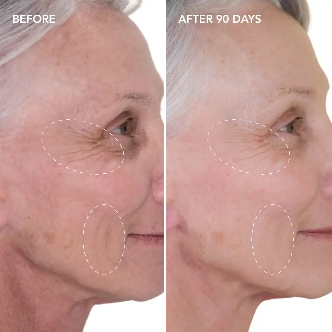 When will you see results Worcester Park